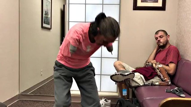 mature double arm amputee